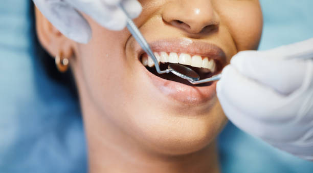 Best Emergency Gum Treatment in Ensley, FL